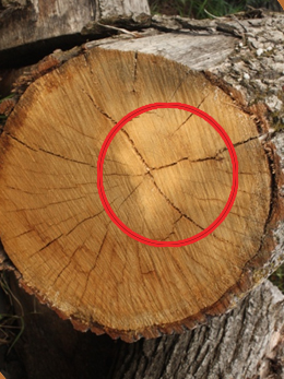 Eclatement médullaire.jpg